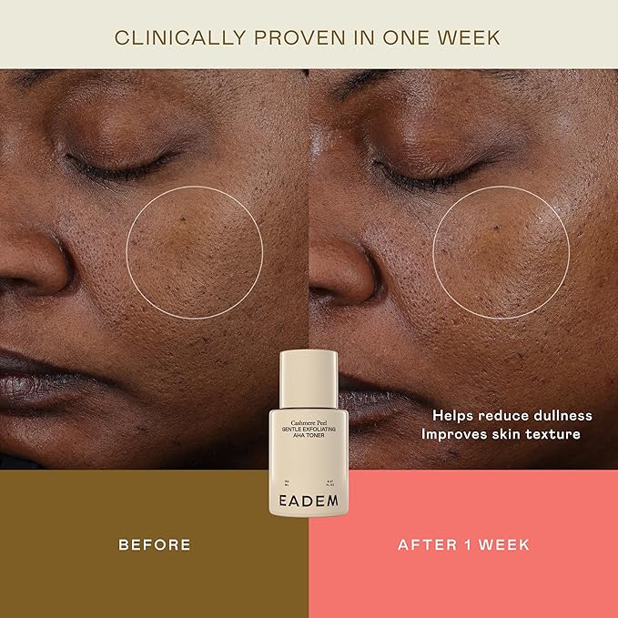 Gentle Exfoliating AHA & PHA Toner, Exfoliating Face Serum with Tranexamic Acid, AHA Exfoliant & Pore Minimizer for Face and Body, Acne Spot Serum, 5.0 oz, Cashmere Peel