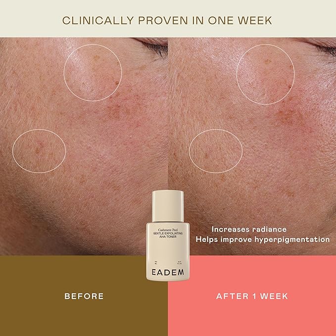Gentle Exfoliating AHA & PHA Toner, Exfoliating Face Serum with Tranexamic Acid, AHA Exfoliant & Pore Minimizer for Face and Body, Acne Spot Serum, 5.0 oz, Cashmere Peel