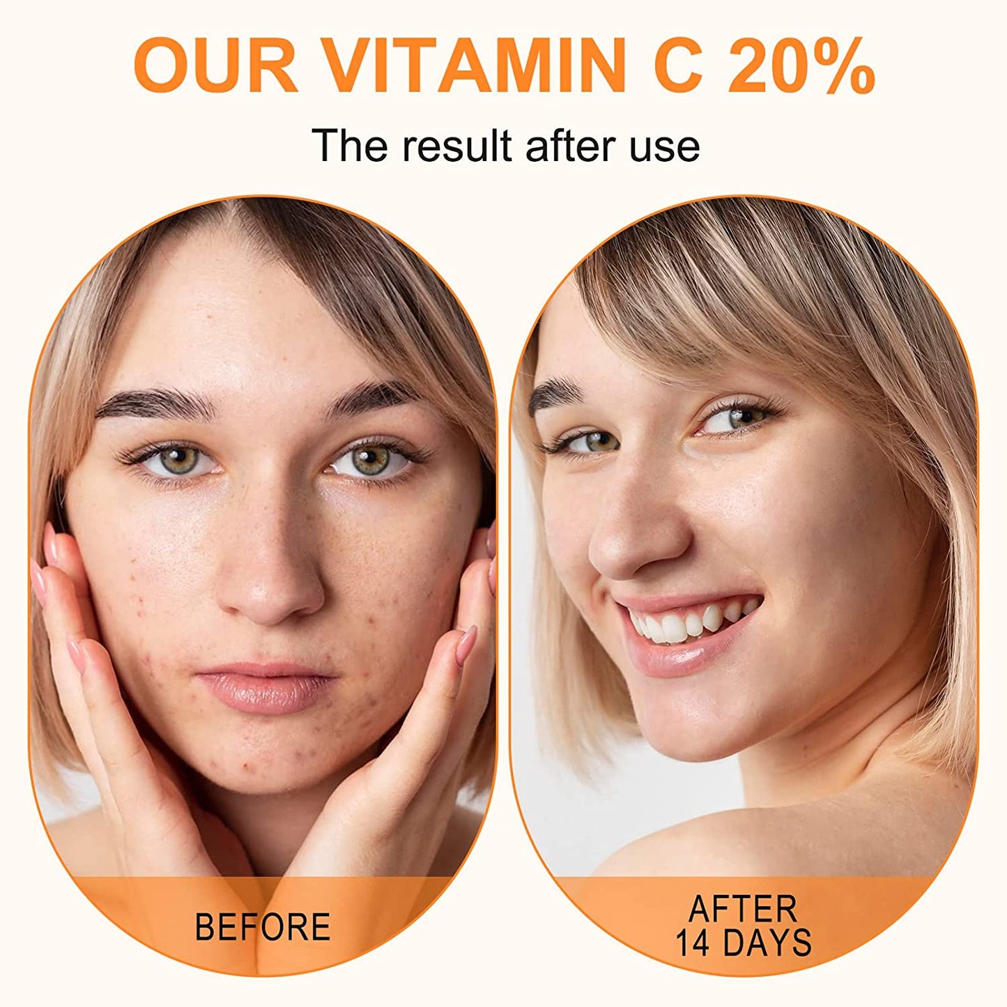 Premium 20% Vitamin C Serum with Hyaluronic Acid, Retinol & Amino Acids – Anti Aging Face Serum for Wrinkles, Hydrating & Collagen Boosting Korean Skin Care, 60ml