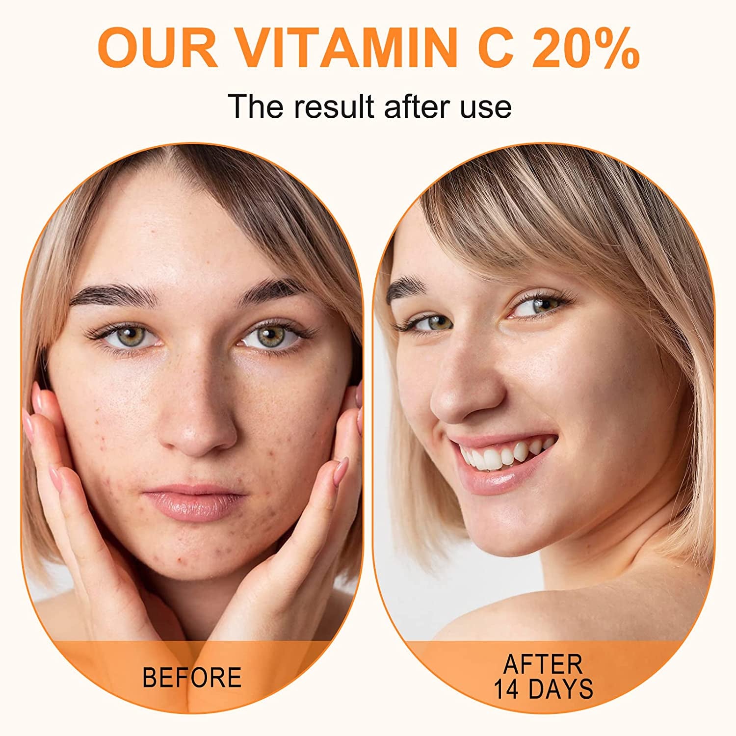 Premium 20% Vitamin C Serum with Hyaluronic Acid, Retinol & Amino Acids – Anti Aging Face Serum for Wrinkles, Hydrating & Collagen Boosting Korean Skin Care, 60ml