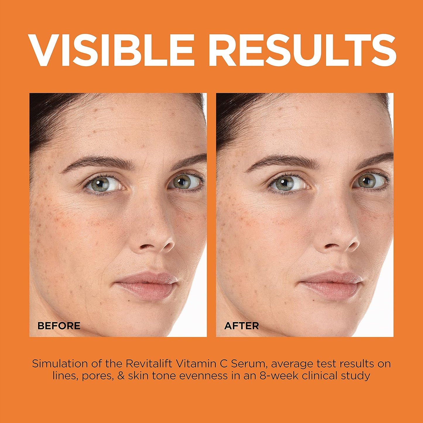 Revitalift 12% Pure Vitamin C Serum – Brightening Serum + Moisturizer Sample ✨🍊