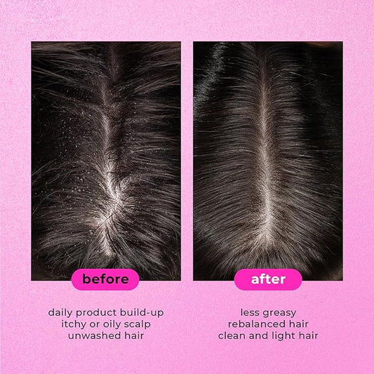 Sea Salt Scrub Shampoo scalp detox treatment