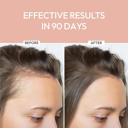 Luxe Cosmetics Hair Growth Serum (30ml) Advanced Formula for Hair Growth Product for Women - Supports Thicker, Fuller, and Shinier Hair - Premium Scalp Serum for Dry Scalp