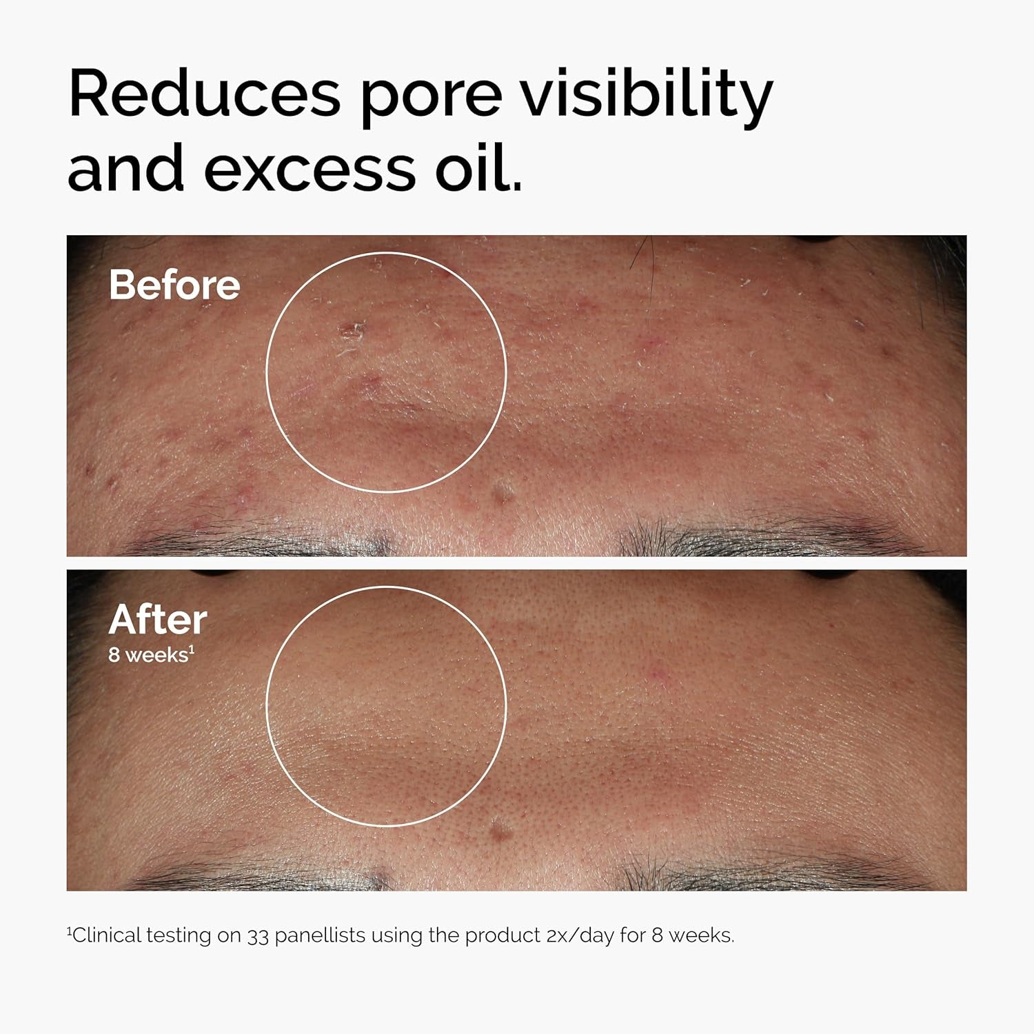 ✨ The Ordinary Skincare Power Trio